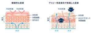 ロゼットAKシリーズ