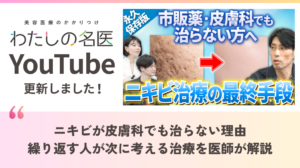 わたしの名医Youtube アルバアレルギークリニック札幌「ニキビが皮膚科でも治らない理由｜繰り返す人が次に考える治療を医師が解説」を公開いたしました。