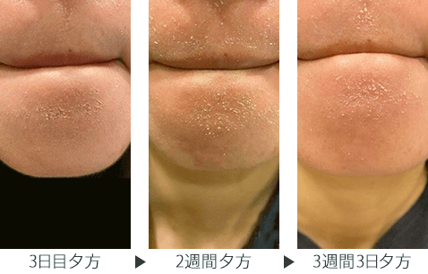 img_column_zoskin_dry-skin img_column_zoskin_dry-skin